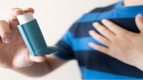 دراسة أمريكية.. عقار لعلاج الربو يوفر إمكانية علاج الحساسية الغذائية
